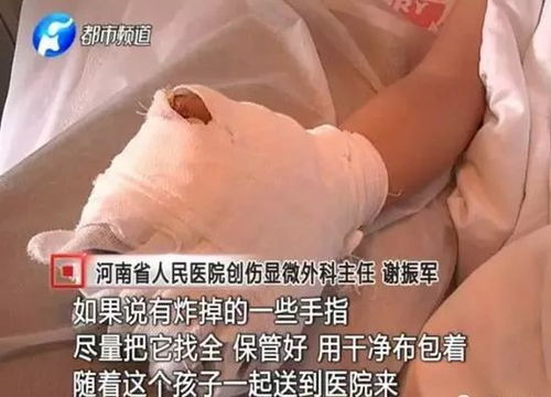 意外失去指节怎么挽回,失去手指关节后如何康复