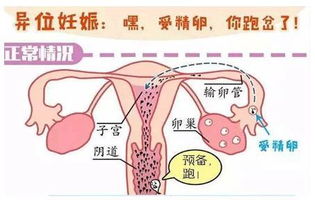 卵巢早衰可以挽回吗,挽救卵巢早衰，重获健康