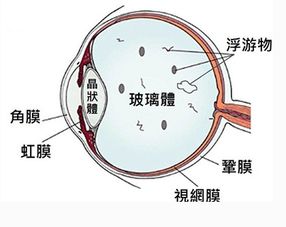 如何挽回视力极度下降,如何恢复极度下降的视力？