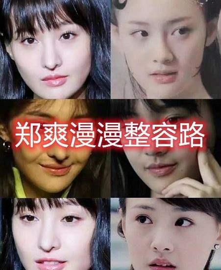 女子整容挽回前男友,悔过自新：女子整容挽回前任