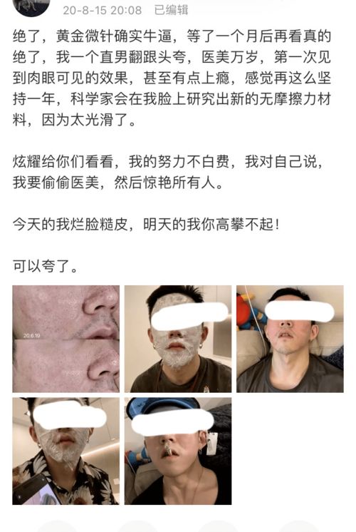 打脸男朋友怎么挽回，重获男友芳心的有效方法