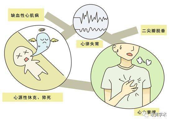 心梗最好挽回方法,避免心梗复发的最佳方法